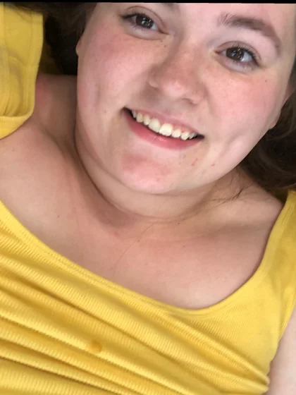 Dimples